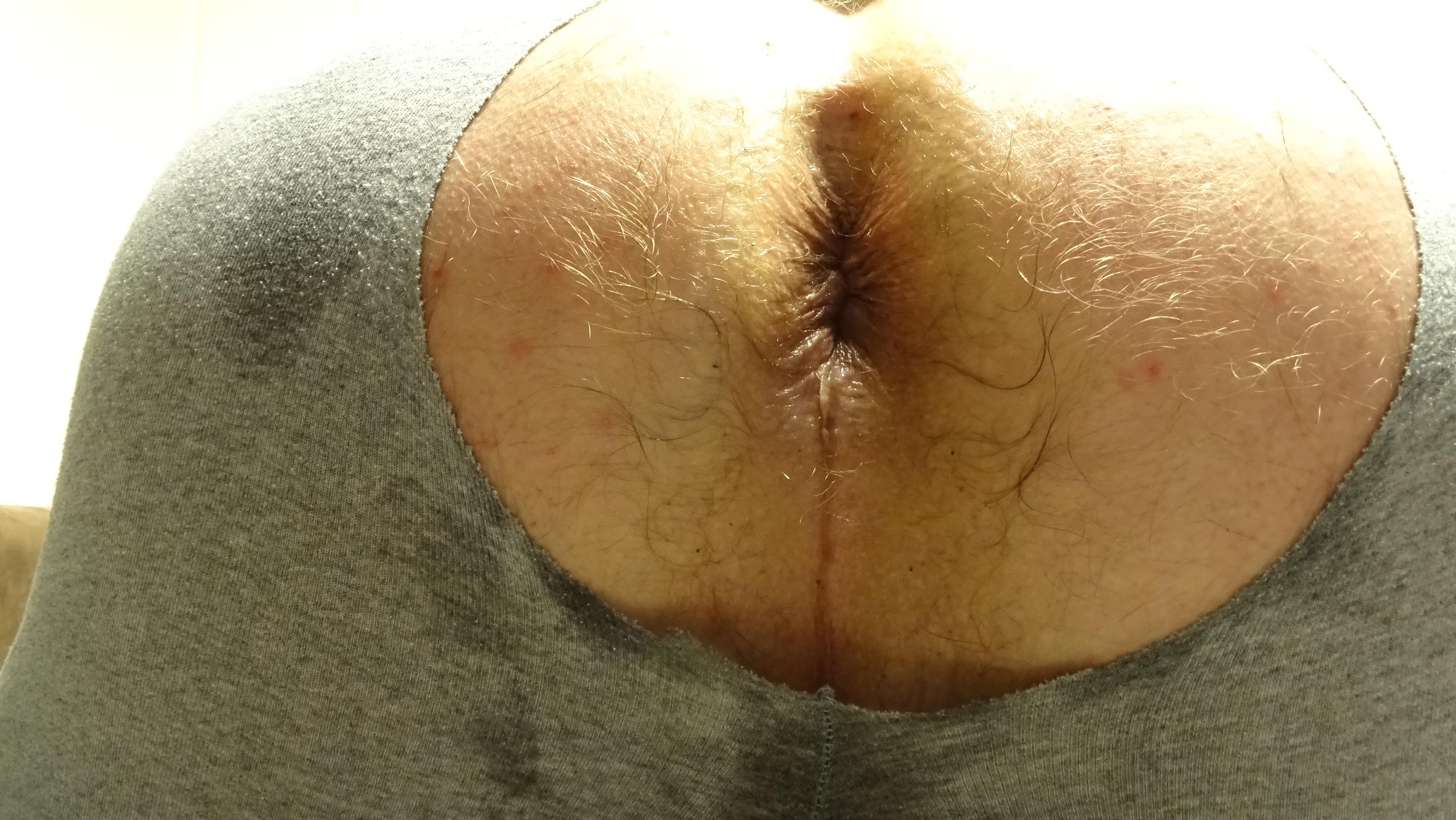 anallover331 from Germany
